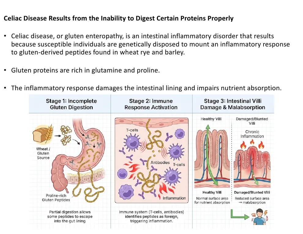 Celiac Disease: When You Cannot Finish Digesting a Protein